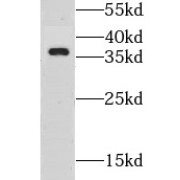 WB analysis of Transfected HEK-293 cells, using GSG1L antibody (1/700 dilution).