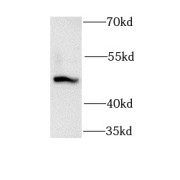 WB analysis of human serum tissue, using GSK3A antibody (1/1000 dilution).