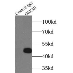 Glycogen Synthase Kinase 3 Beta (GSK3B) Antibody