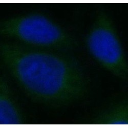 Glycogen Synthase Kinase 3 Beta (GSK3B) Antibody