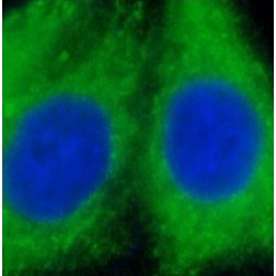 Glutathione S Transferase Alpha 1 (GSTA1) Antibody