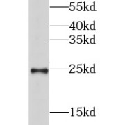 WB analysis of mouse testis tissue, using GSTA3 antibody (1/1000 dilution).