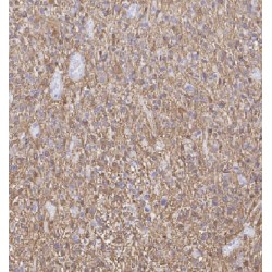 Glutathione S Transferase Mu 1 (GSTM1) Antibody