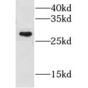 WB analysis of mouse ovary tissue, using GSTM1 antibody (1/500 dilution).