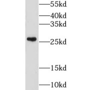 WB analysis of mouse liver tissue, using GSTM4 antibody (1/500 dilution).