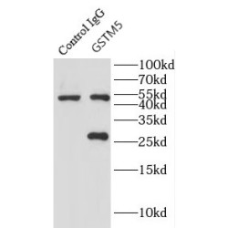 Glutathione S Transferase Mu 5 (GSTM5) Antibody