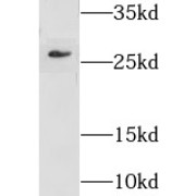 WB analysis of mouse testis tissue, using GSTM5 antibody (1/1000 dilution).