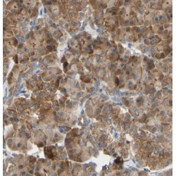 Glutathione S Transferase Omega 1 (GSTO1) Antibody