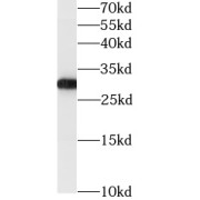 WB analysis of human heart tissue, using GSTO1 antibody (1/3000 dilution).