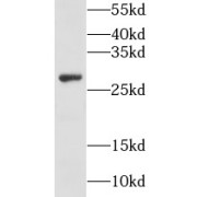 WB analysis of mouse testis tissue, using GSTO2 antibody (1/1000 dilution).