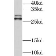 WB analysis of human brain tissue, using GSTT1 antibody (1/500 dilution).