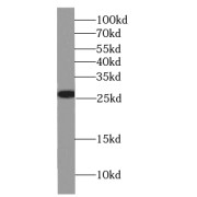 WB analysis of HepG2 cells, using GSTT2B antibody (1/500 dilution).