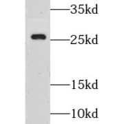 WB analysis of mouse liver tissue, using GSX1 antibody (1/500 dilution).