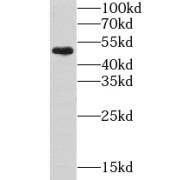 WB analysis of HEK-293 cells, using GTF2E1 antibody (1/1000 dilution).