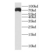 WB analysis of K-562 cells, using GTF2F1 antibody (1/1000 dilution).