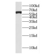 WB analysis of human brain tissue, using GTF2H1 antibody (1/200 dilution).