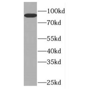 WB analysis of HeLa cells, using GTF3C4 antibody (1/1000 dilution).