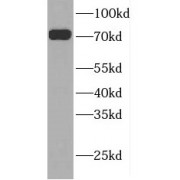 WB analysis of mouse skeletal muscle tissue, using GTPBP1 antibody (1/600 dilution).