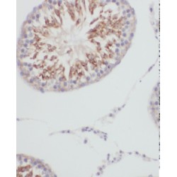 GTP Binding Protein 5 (GTPBP5) Antibody