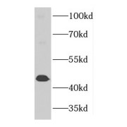 WB analysis of Jurkat cells, using GTPBP5 antibody (1/500 dilution).