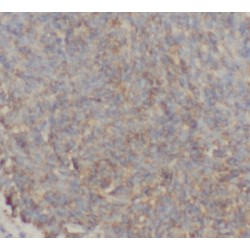 G2 And S Phase-Expressed Protein 1 (GTSE1) Antibody