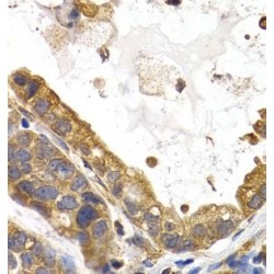 Glycogen Synthase 1, Muscle (GYS1) Antibody