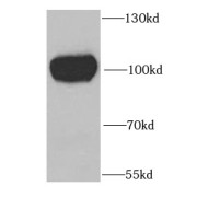 WB analysis of K-562 cells, using GYS1 antibody (1/1000 dilution).