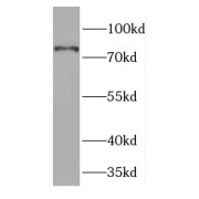 WB analysis of fetal human brain tissue, using HAP1 antibody (1/600 dilution).