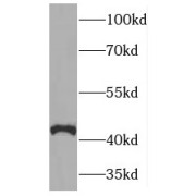 WB analysis of mouse brain tissue, using HAPLN4 antibody (1/1200 dilution).