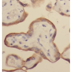 Chromosome 14 Open Reading Frame 94 (HAUS4) Antibody