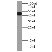 WB analysis of mouse spleen tissue, using HB9 antibody (1/600 dilution).