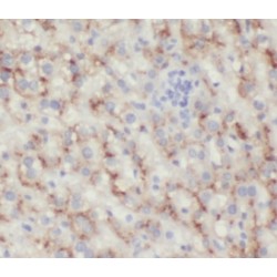 Hemoglobin Beta (HBB) Antibody