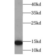 WB analysis of human heart tissue, using HBB antibody (1/2000 dilution).