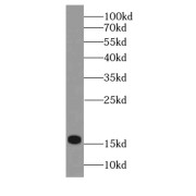 WB analysis of human heart tissue, using HBM-Specific antibody (1/500 dilution).