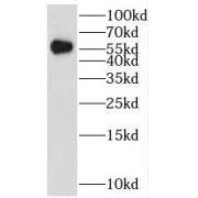 WB analysis of human brain tissue, using HBP1 antibody (1/1000 dilution).