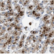 IHC-P analysis of human hepatocirrhosis tissue, using HBQ1 antibody (1/50 dilution).