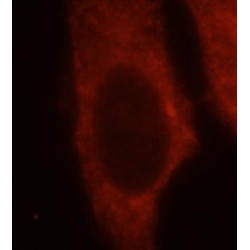 HBS1-Like Protein (HBS1L) Antibody