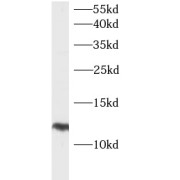 WB analysis of Transfected HEK-293 cells, using HBXIP antibody (1/800 dilution).