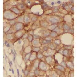 Holocytochrome C Synthase (HCCS) Antibody