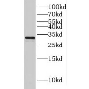 WB analysis of human heart tissue, using HCCS antibody (1/500 dilution).