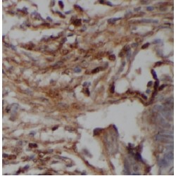 Host Cell Factor 1 (HCFC1) Antibody