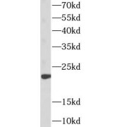 WB analysis of JAR cells, using hCG alpha antibody antibody (1/1000 dilution).