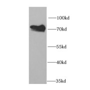 WB analysis of Jurkat cells, using HCLS1 antibody (1/1000 dilution).