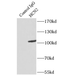 Potassium/sodium Hyperpolarization-Activated Cyclic Nucleotide-Gated Channel 2 (HCN2) Antibody