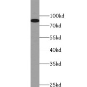 WB analysis of human kidney tissue, using HCN3 antibody (1/800 dilution).