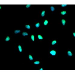 Histone Deacetylase 1 (HDAC1) Antibody