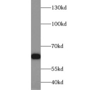 WB analysis of HepG2 cells, using HDAC1 antibody (1/1000 dilution).