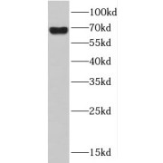 WB analysis of fetal human brain tissue, using HDAC10 antibody (1/600 dilution).