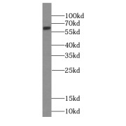 WB analysis of mouse testis tissue, using HDAC1-specific antibody (1/500 dilution).