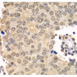 Histone Deacetylase 2 (HDAC2) Antibody